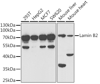 Lamin B2 Rabbit polyclonal antibody