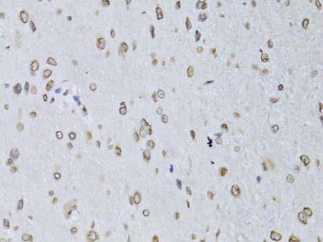 Lamin B2 Rabbit polyclonal antibody