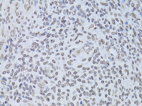Lamin B2 Rabbit polyclonal antibody