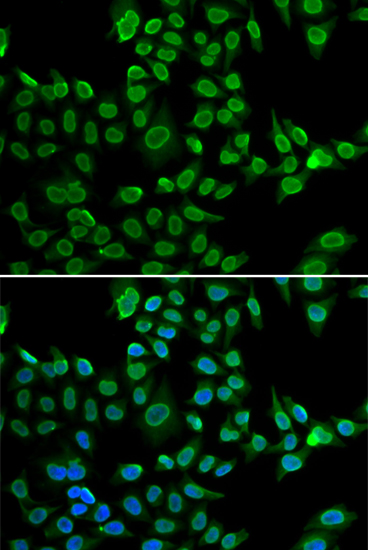 Lamin B2 Rabbit polyclonal antibody