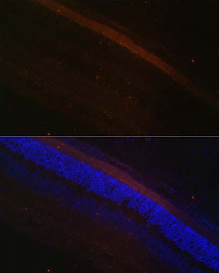 GRK1 Rabbit polyclonal antibody