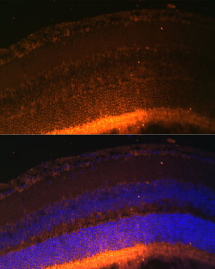 GRK1 Rabbit polyclonal antibody