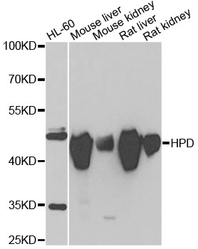 HPD Rabbit polyclonal antibody