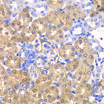 HPD Rabbit polyclonal antibody