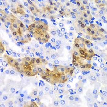 HPD Rabbit polyclonal antibody