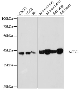 ACTC1 Rabbit polyclonal antibody