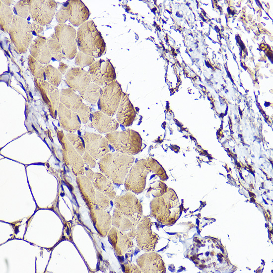 ACTC1 Rabbit polyclonal antibody