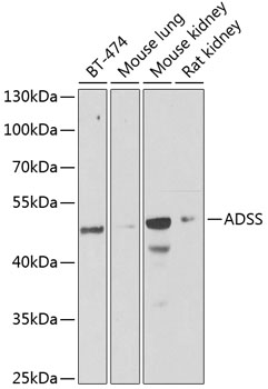 ADSS Rabbit polyclonal antibody
