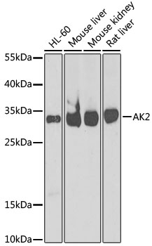 [KO Validated] AK2 Rabbit polyclonal antibody