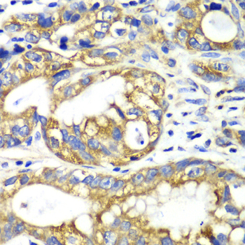 [KO Validated] AK2 Rabbit polyclonal antibody
