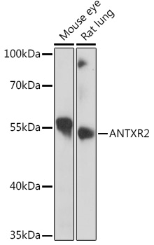ANTXR2 Rabbit polyclonal antibody