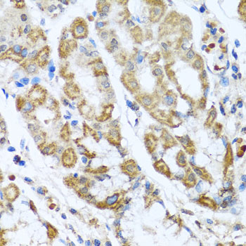 ANTXR2 Rabbit polyclonal antibody