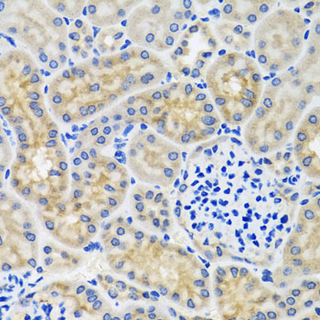 ANTXR2 Rabbit polyclonal antibody