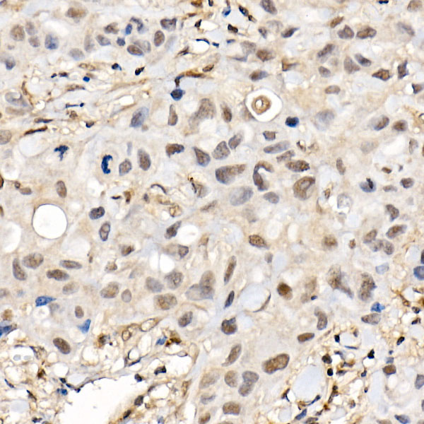 BAP1 Rabbit polyclonal antibody
