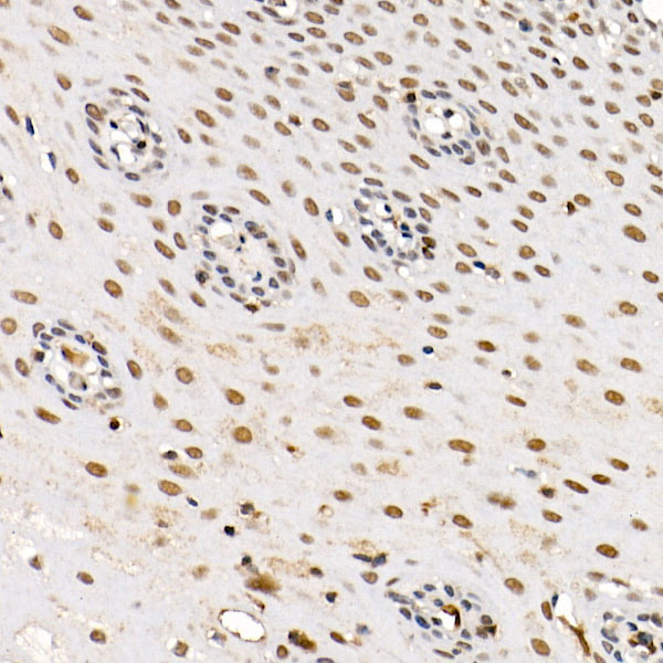 BAP1 Rabbit polyclonal antibody