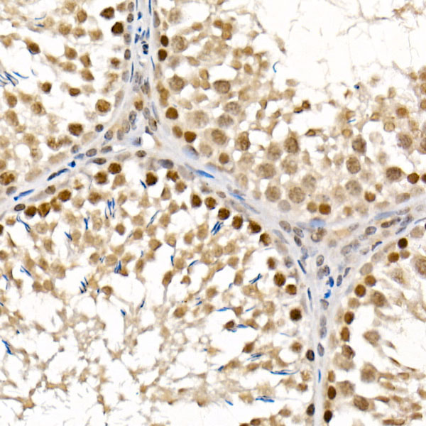 BAP1 Rabbit polyclonal antibody