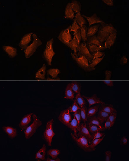 BAP1 Rabbit polyclonal antibody