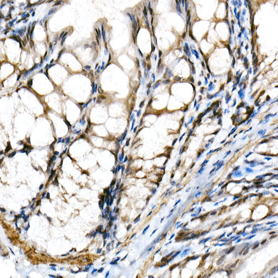 BHLHE40 Rabbit polyclonal antibody