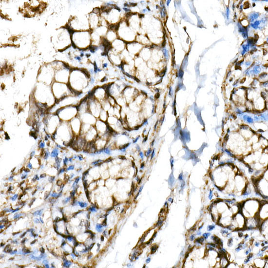 BHLHE40 Rabbit polyclonal antibody