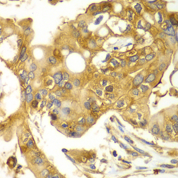 Calpain small subunit 1 Rabbit polyclonal antibody