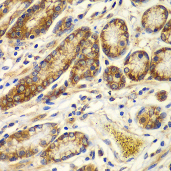 Calpain small subunit 1 Rabbit polyclonal antibody