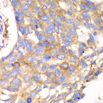 Calpain small subunit 1 Rabbit polyclonal antibody