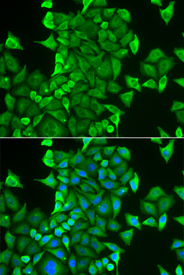 CARS Rabbit polyclonal antibody