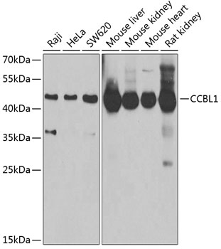 CCBL1 Rabbit polyclonal antibody