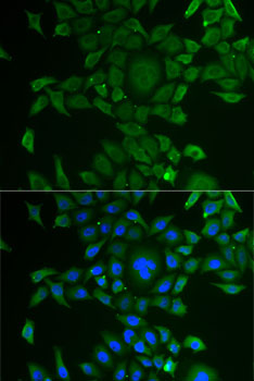 CCBL1 Rabbit polyclonal antibody