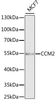 CCM2 Rabbit polyclonal antibody