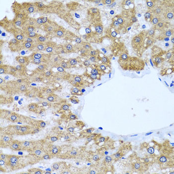 CCM2 Rabbit polyclonal antibody