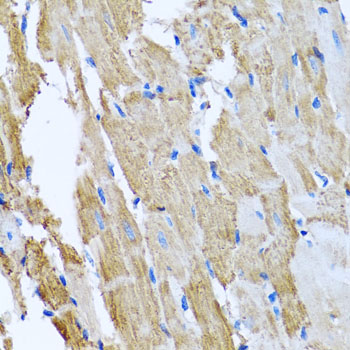 CCM2 Rabbit polyclonal antibody