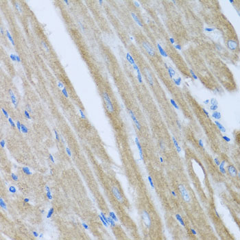 CCM2 Rabbit polyclonal antibody