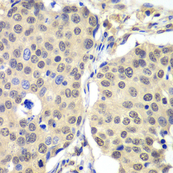 Cyclin C Rabbit polyclonal antibody