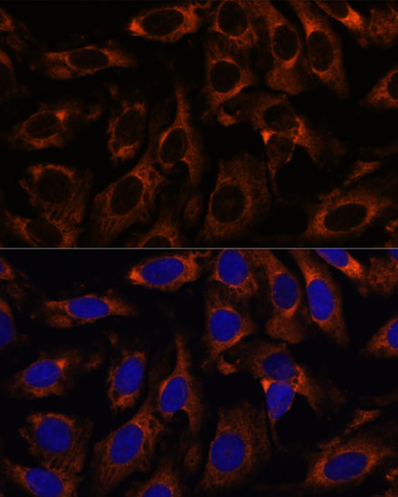 CCT3 Rabbit polyclonal antibody