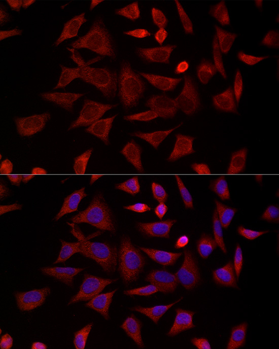 CCT4 Rabbit polyclonal antibody