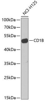 CD1B Rabbit pAb