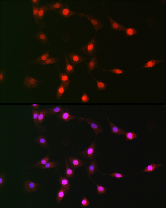 CDKN2D Rabbit polyclonal antibody