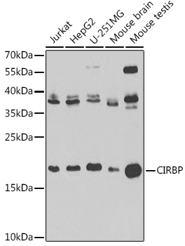 [KO Validated] CIRBP Rabbit polyclonal antibody