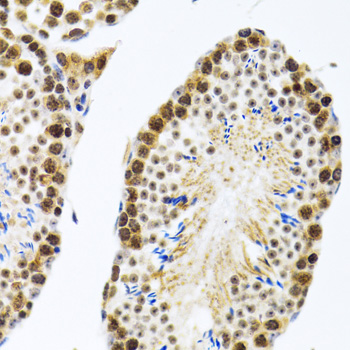 [KO Validated] CIRBP Rabbit polyclonal antibody