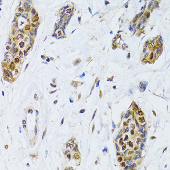 [KO Validated] CIRBP Rabbit polyclonal antibody