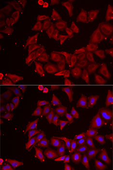CMPK1 Rabbit polyclonal antibody