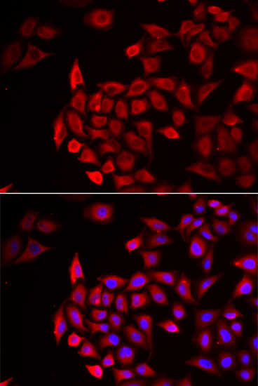 COCH Rabbit polyclonal antibody