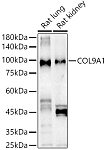Western blot - COL9A1 Rabbit pAb (A6563)