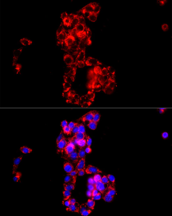 COX IV Rabbit polyclonal antibody