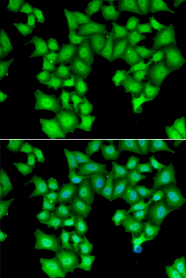CPSF3L Rabbit polyclonal antibody
