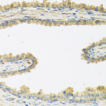 CRHBP Rabbit polyclonal antibody