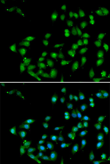CTNNBL1 Rabbit polyclonal antibody