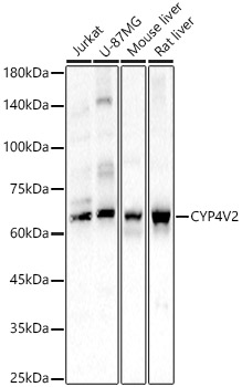 CYP4V2 Rabbit polyclonal antibody