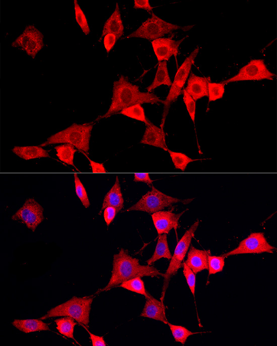 CYP4V2 Rabbit polyclonal antibody